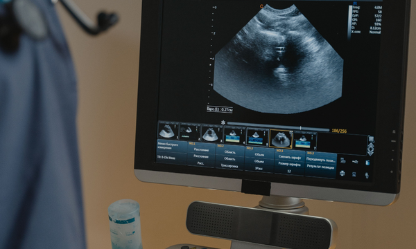 In-Office Ultrasound Imaging in Phoenix, AZ