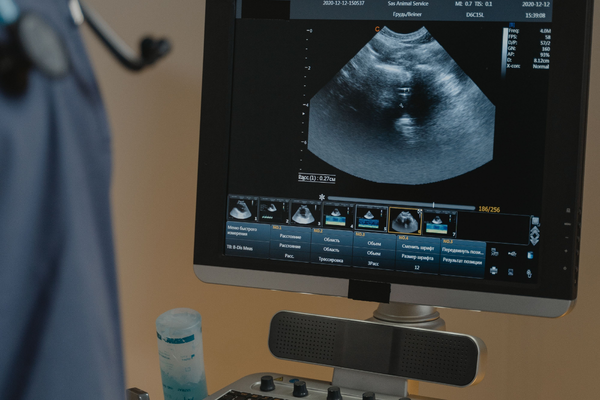 In-Office Ultrasound Imaging in Phoenix, AZ at All family Care
